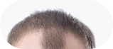 Skin Story Image