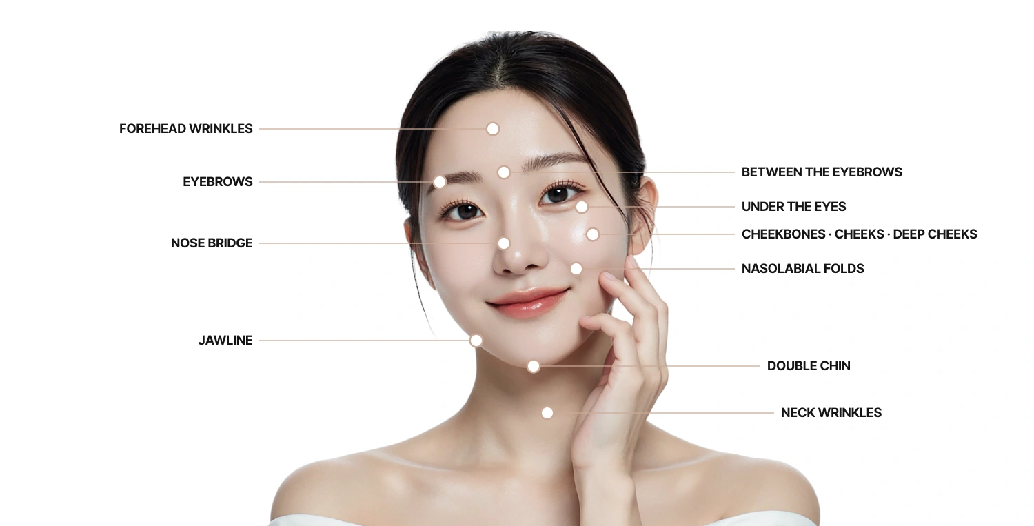 Thread Lifting Treatment Areas