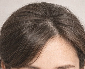 Hairline