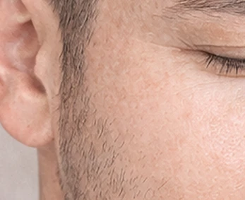 Sideburns