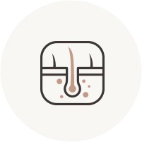 Excessive sebum and enlarged pores