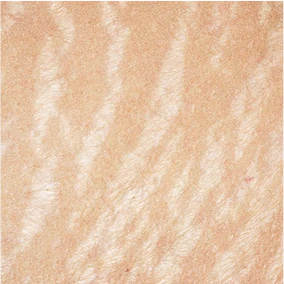 Mature-Stage Striae Albae